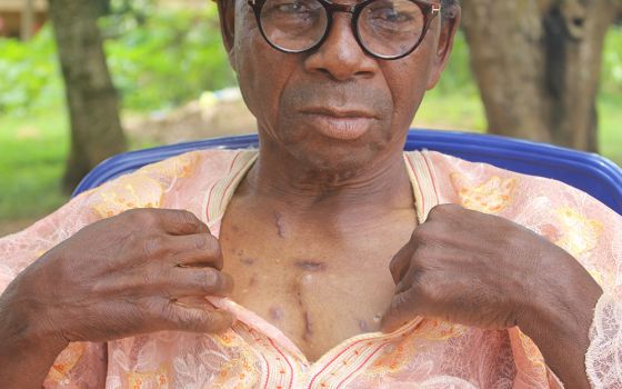 Despite a gunshot wound to his chest, Bade Salau, 74, survived the Black Sunday attack on St. Francis Xavier Catholic Church June 5 in Owo, Ondo, Nigeria. (GSR photo/Valentine Iwenwanne)